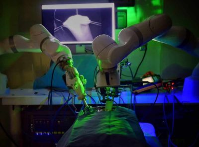 Robotic surgery - performed at Johns Hopkins University
