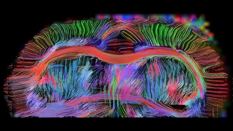 Human neurons inside the brains of juvenile rats