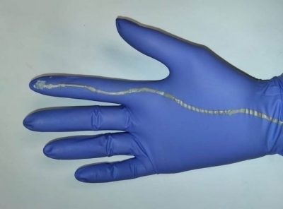 Childbirth and a smart glove to save babies